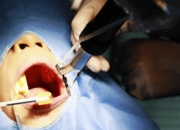 河南大学赛思口腔医院成功展示自主口腔种植牙机器人手术